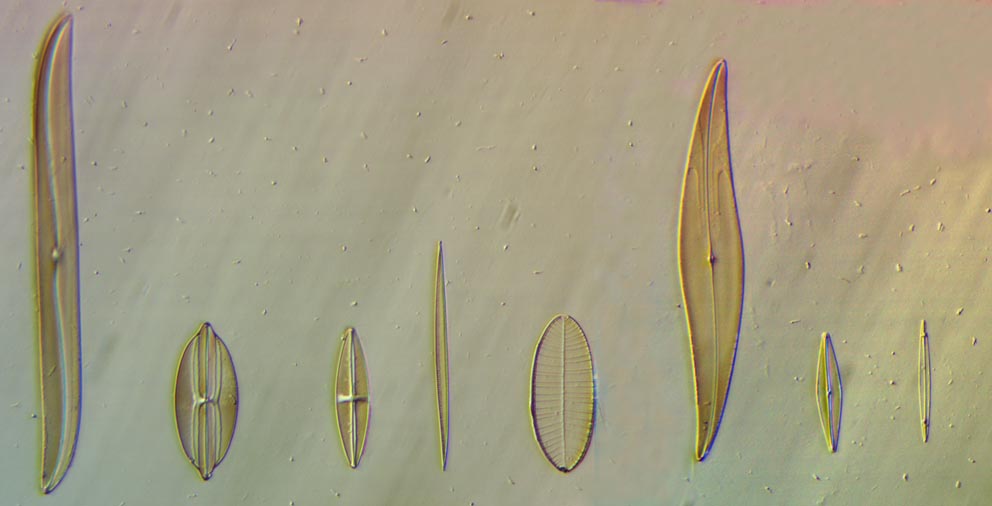 Carolina Biologicial diatom test slide at 20x Hoffman modulation contrast large slit width